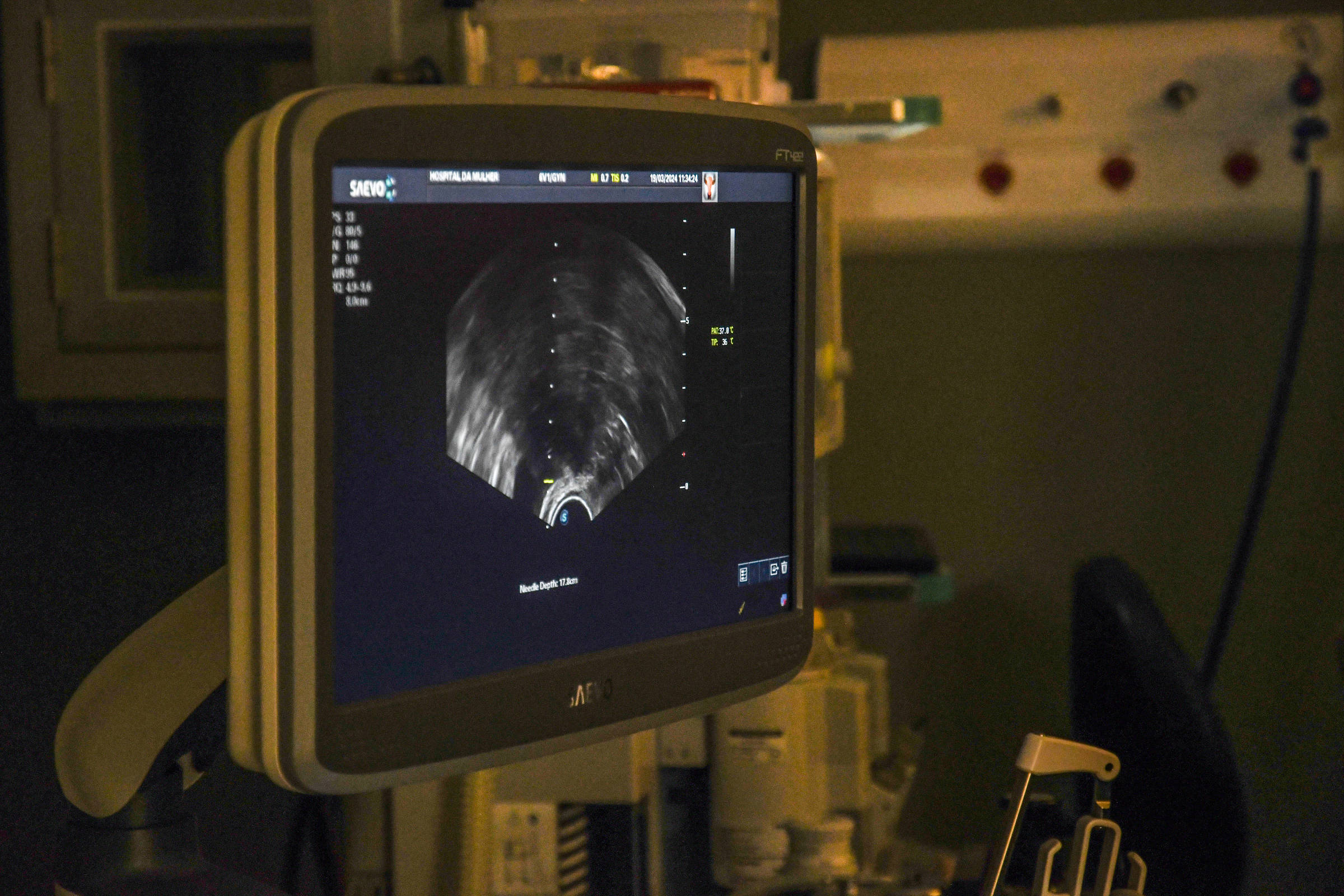 A inseminação artificial caseira deve ser regulamentada? SIM - 07/03/2025 - Opinião