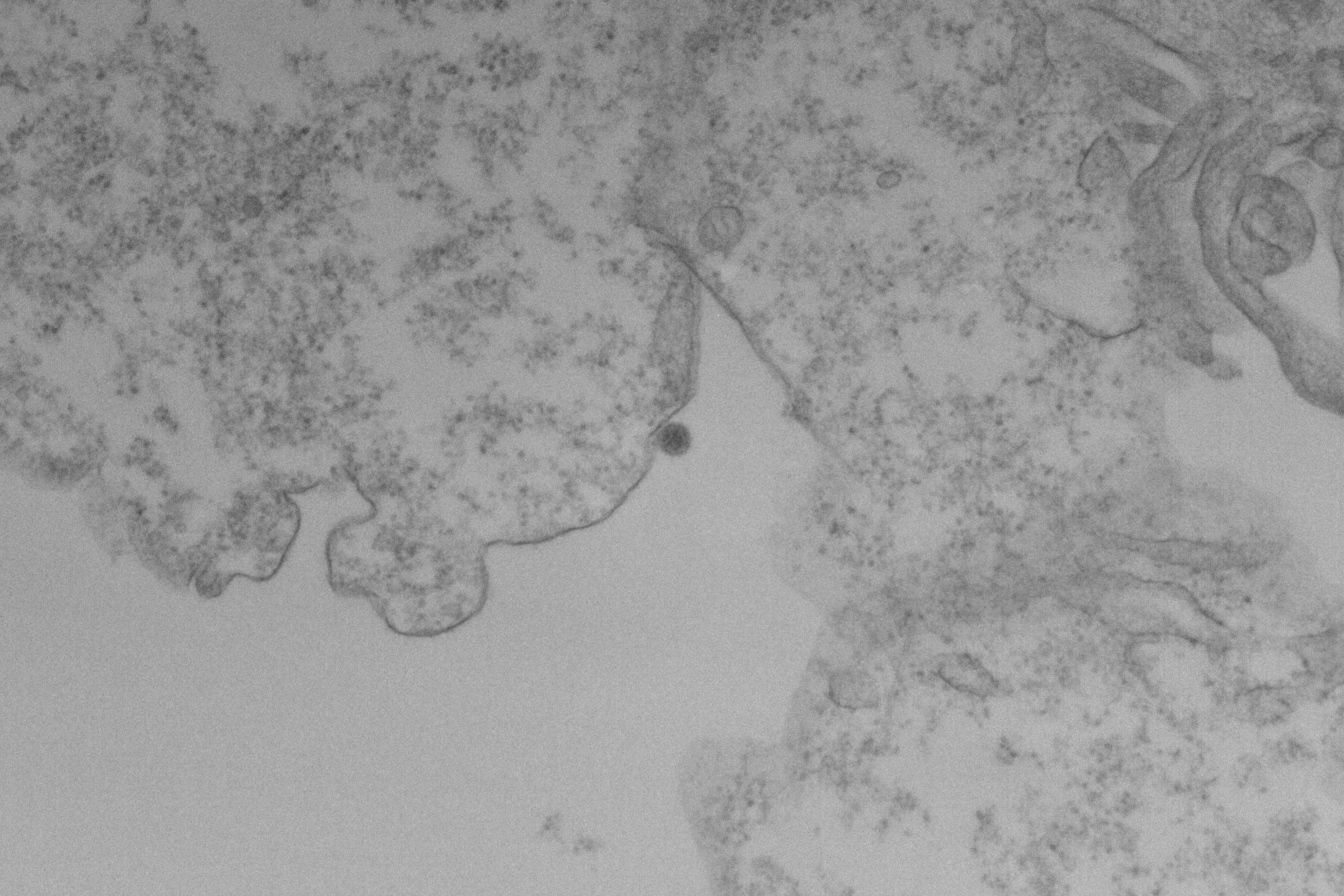 A imagem mostra uma visualização em alta ampliação, possivelmente de uma amostra biológica ou material em uma lâmina. A estrutura é predominantemente em tons de cinza, com áreas de textura irregular e algumas formas escuras que podem representar partículas ou estruturas celulares. A escala na parte inferior indica que a imagem foi capturada em uma ampliação significativa, sugerindo detalhes microscópicos.