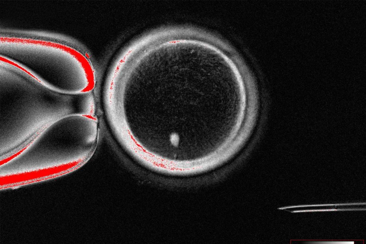 Imagem microscópica em preto e branco mostra uma célula redonda sendo manipulada por uma micropipeta à esquerda e uma microagulha fina à direita