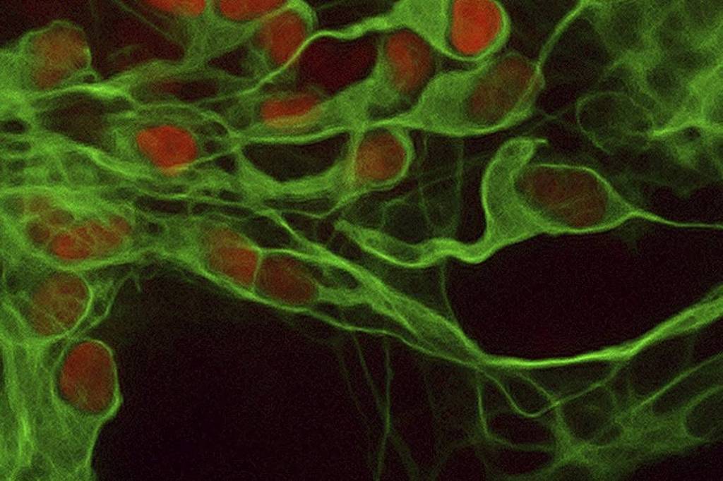 Conjunto de neurônios motores. As células são verdes com os núcleos em vermelho em um fundo preto. É possível ver a conexão entre elas.