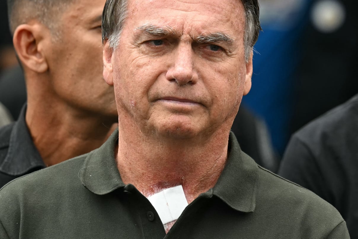 Bolsonaro será submetido a endoscopia nesta quarta-feira (31)