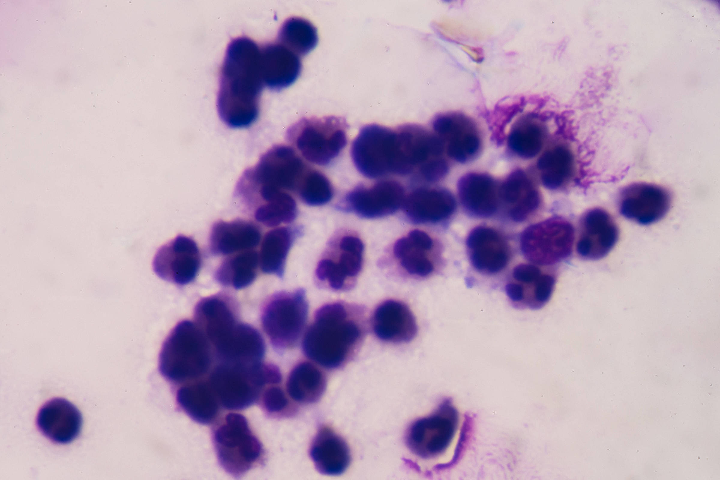 Como bioeletricidade pode abrir novas vias contra o câncer - 08/03/2026 - Marcelo Leite