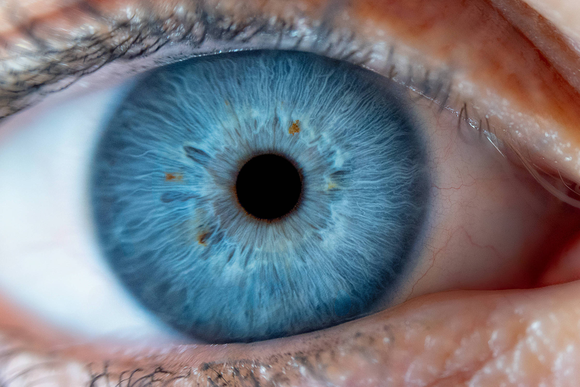 Imagem macro de um olho humano com íris azul-clara e distintas manchas marrons espalhadas por toda a sua extensão, destacando a textura natural do olho e sua combinação de cores única.