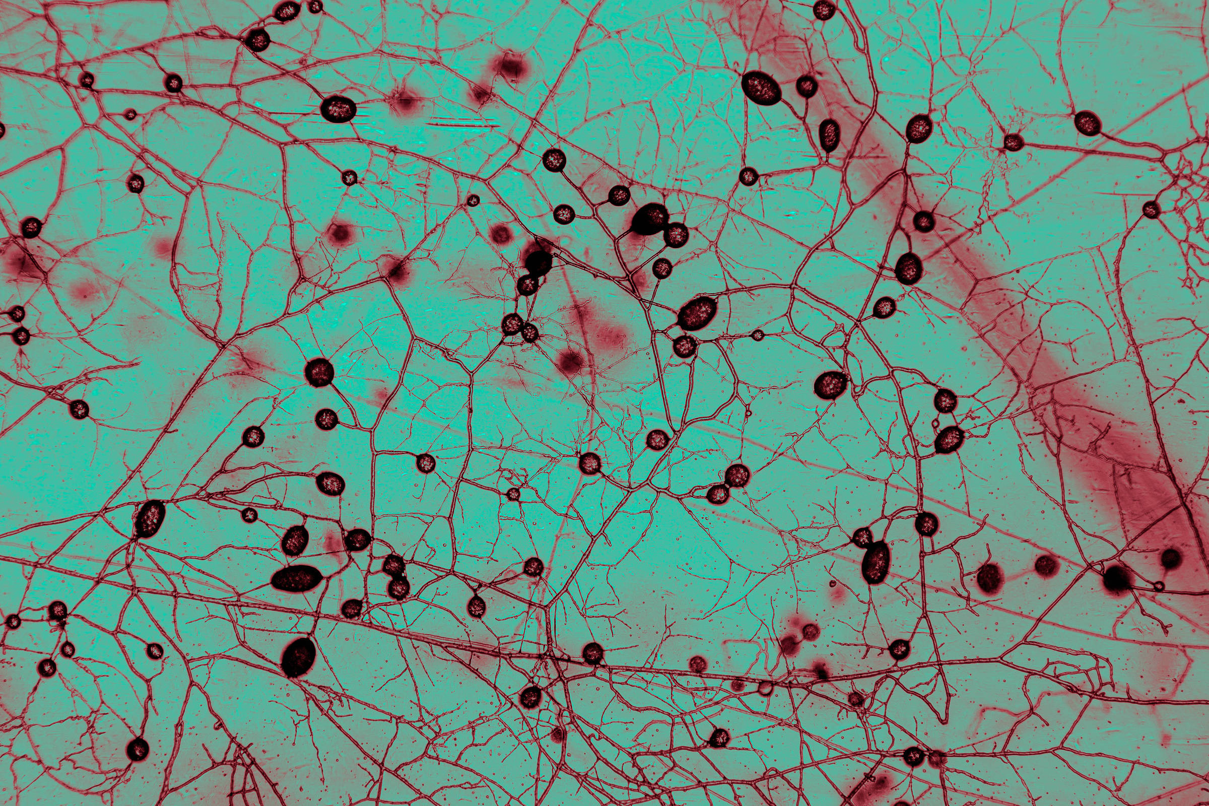 Imagem microscópica mostra uma rede complexa de neurônios com extensões ramificadas finas em vermelho sobre fundo azul esverdeado. Núcleos escuros e ovais estão distribuídos ao longo das ramificações, evidenciando a estrutura celular.