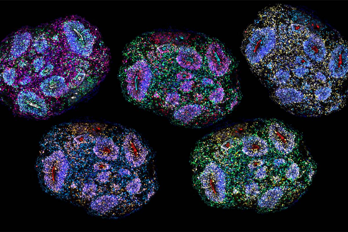 'Minicérebros' de laboratório sobrevivem por cinco anos - 19/08/2026 - Ciência