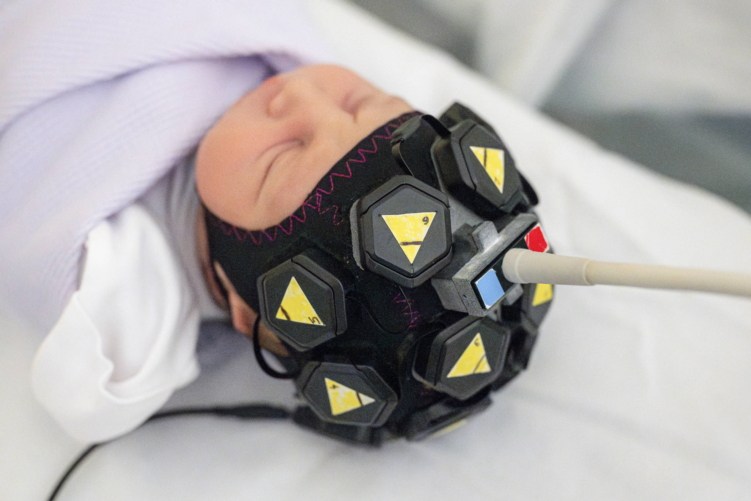Bebê dormindo com touca preta equipada com sensores hexagonais amarelos conectados a um dispositivo branco. O bebê está deitado sobre tecido branco e usa uma touca lilás por baixo.